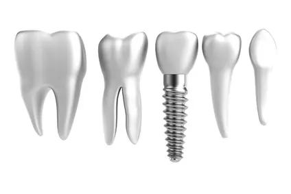 Implantate